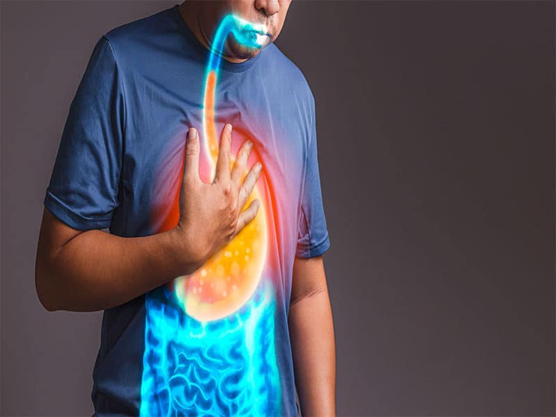 Gastroesophageal Reflux Disease